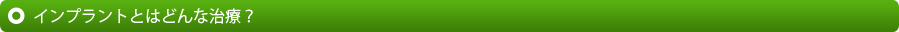 インプラントとはどんな治療？